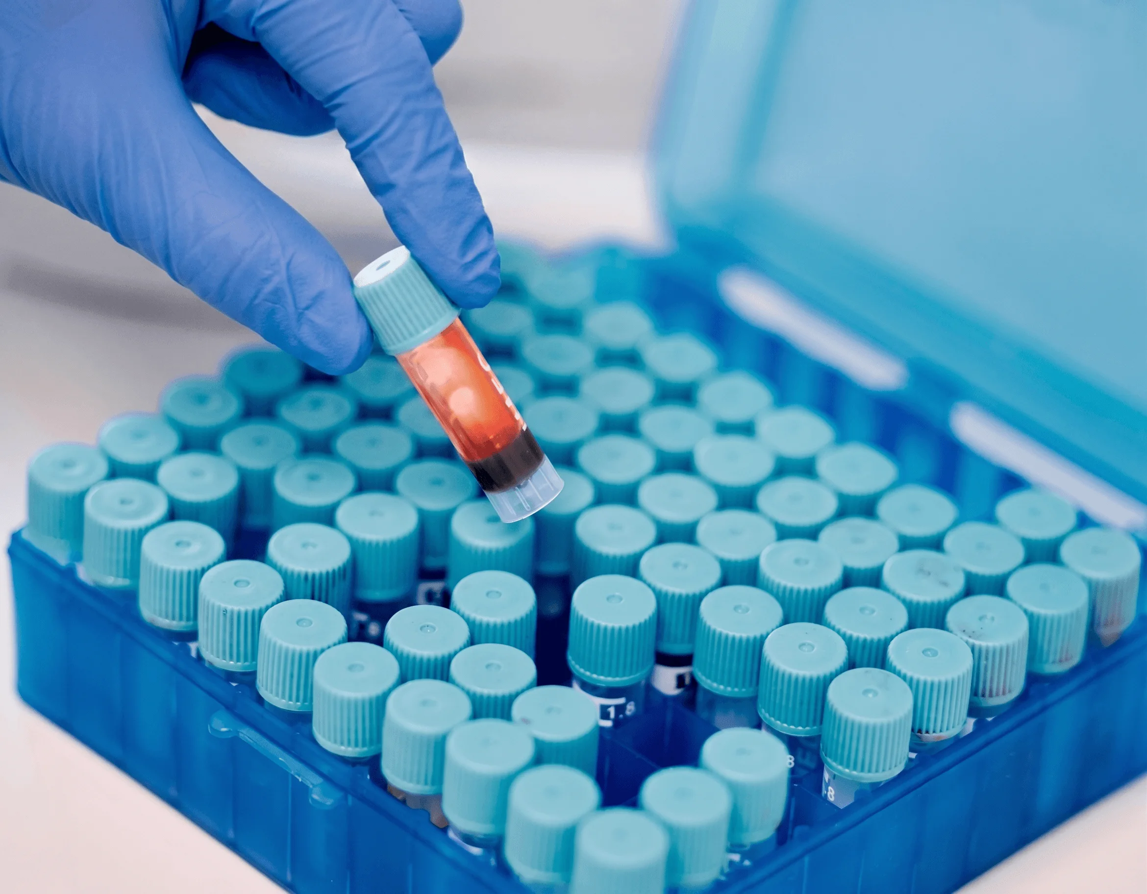 Acondicionamento de amostras veterinárias em caixa térmica apropriada